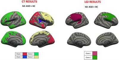 Assessing cortical features in early stage ASD children